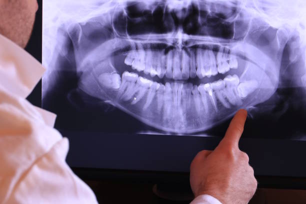 Best Emergency Dental Services for Seniors in Hauppauge, NY