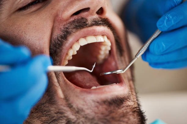 Best Emergency Dentist for Knocked-Out Tooth in Hauppauge, NY