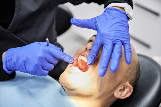 Best Broken or Cracked Tooth Emergency Dentist in Hauppauge, NY